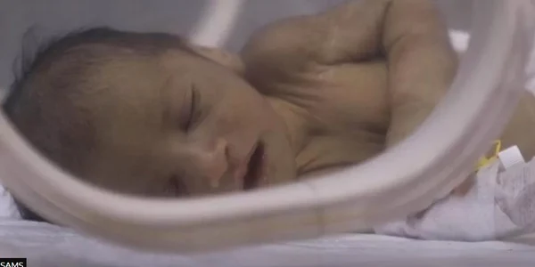 FOTO SAMS via BBC jpg
