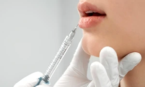 botox injectii acid hialuronic interventii estetice foto shutterstock