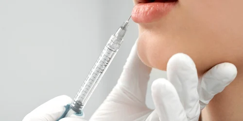 botox injectii acid hialuronic interventii estetice foto shutterstock