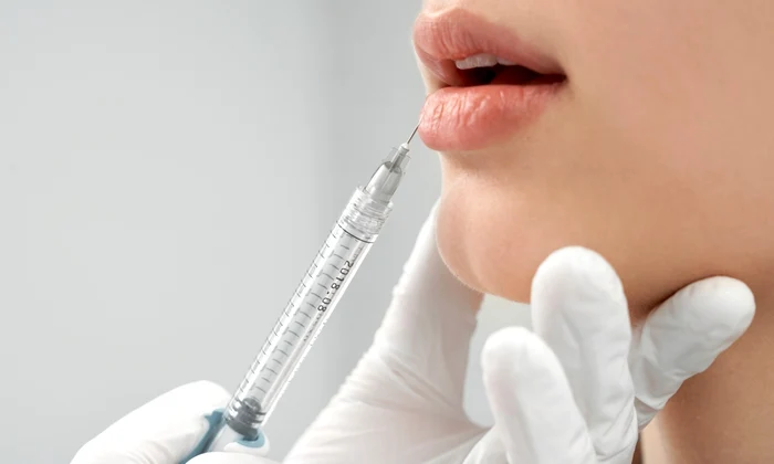 botox injectii acid hialuronic interventii estetice foto shutterstock
