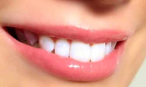 1 75163 original jpg jpeg