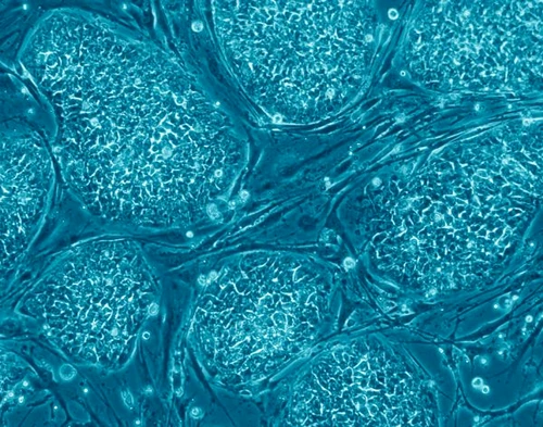 22 wc human embryonic stem cells jpg jpeg