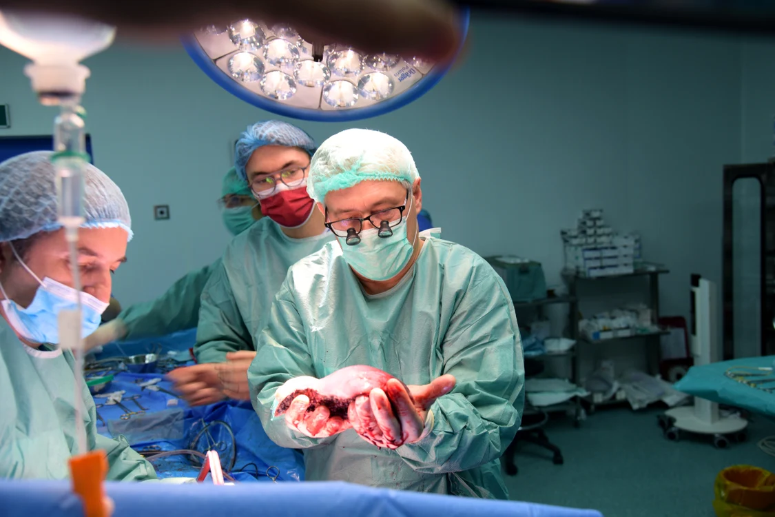 Transplant hepatic. FOTO: Sanador