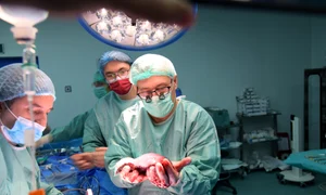 Prof  Dr  Vlad Brasoveanu transplant hepatic png