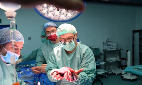 Prof  Dr  Vlad Brasoveanu transplant hepatic png