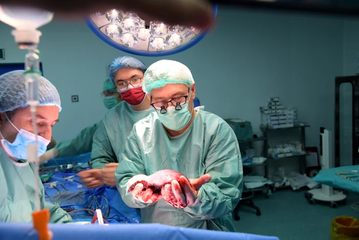 Transplant hepatic. FOTO: Sanador