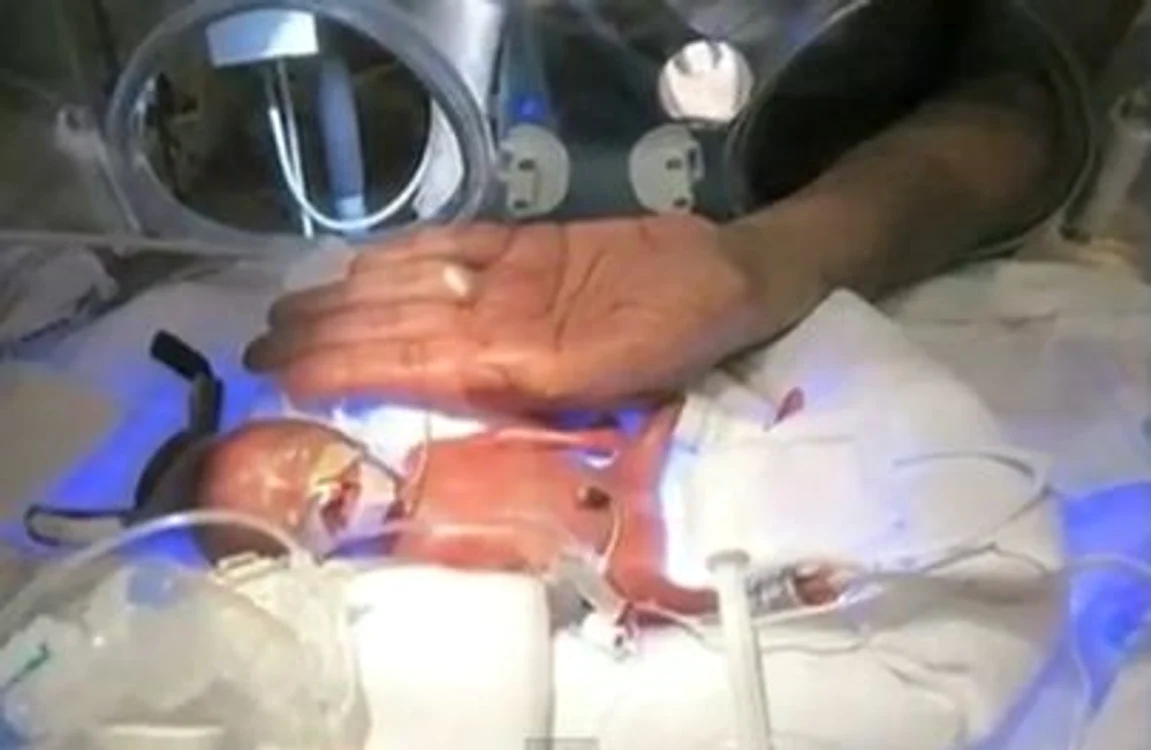 Melinda cântărea la naştere 280 de grame (Foto: capturi Youtube)