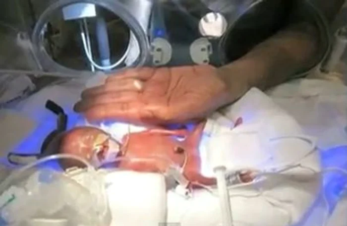 Melinda cântărea la naştere 280 de grame (Foto: capturi Youtube)