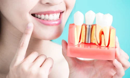 1 clicksanatate implantologiesector4 jpg jpeg