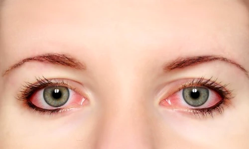 1 69924 original jpg jpeg