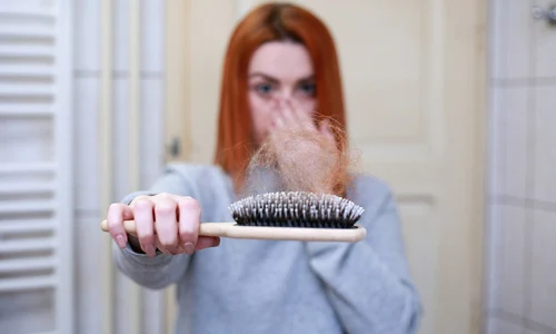 1 hair loss 4818761 1280 jpg jpeg