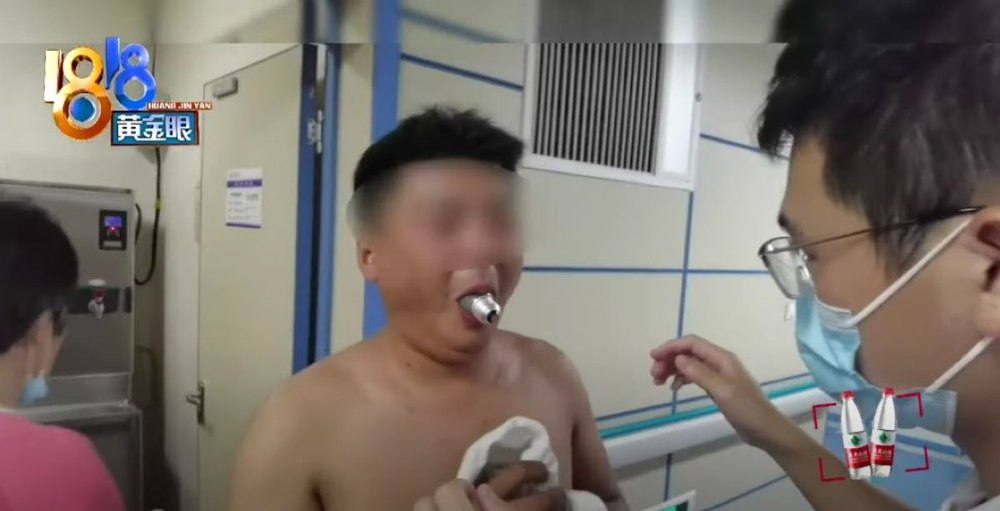 Și-a băgat un bec în gură după ce a văzut un clip pe internet. Ce a pățit un bărbat din China după aceea VIDEO
