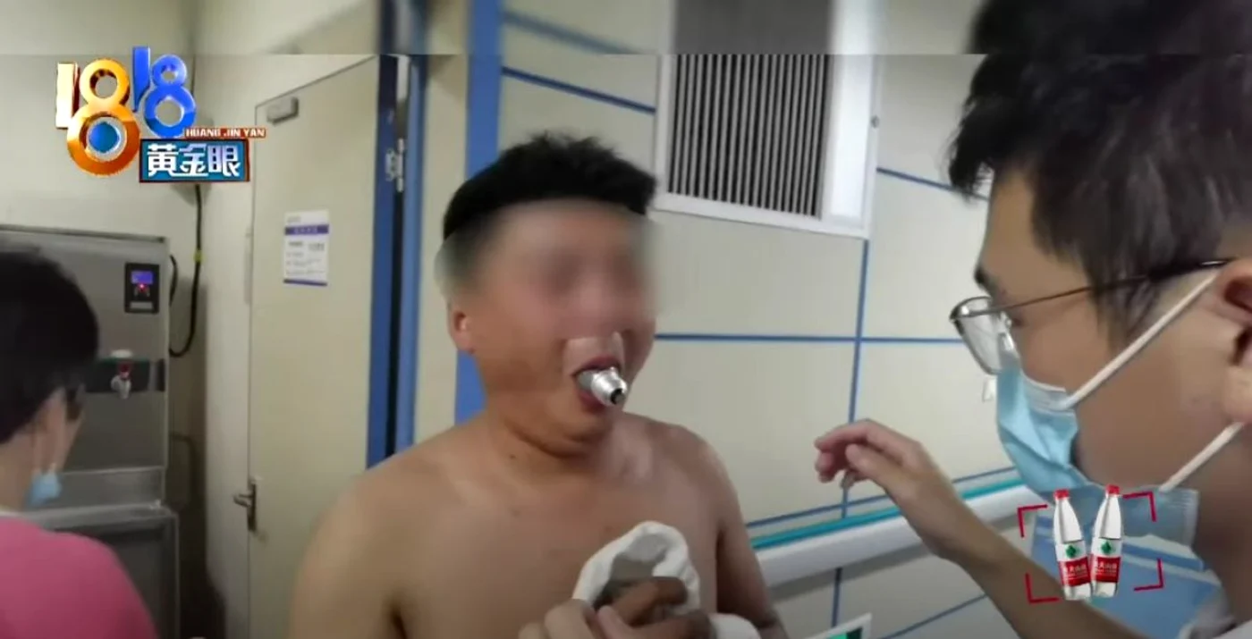 Un bărbat din China și-a introdus un bec în gură. Foto Captură video YouTube