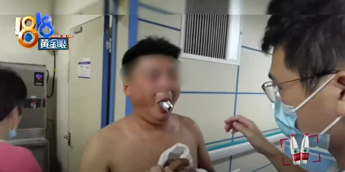 Un bărbat din China și a îndesat un bec în gură  Foto Captură video YouTube jpg
