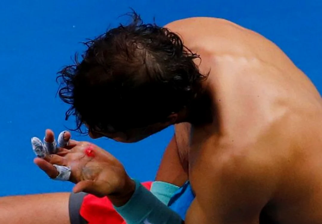 Nadal
