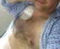 A fost operat de cancer la rinichi, în urmă cu 4 ani