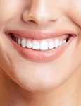 dinti albi_shutterstock 2483275985 jpg