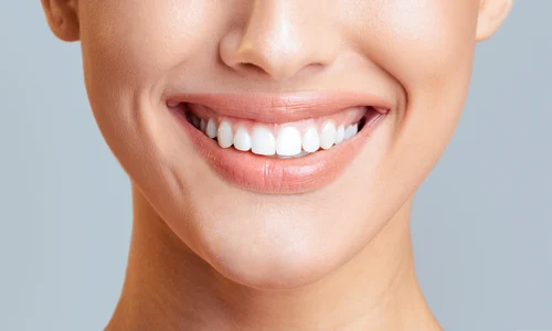 dinti albi_shutterstock 2483275985 jpg