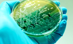 Bacteria Pseudomonas aeruginosa în mediu de cultură FOTO SHUTTERSTOCK