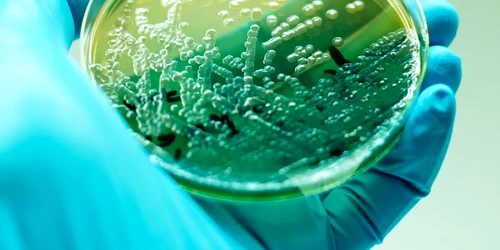 Bacteria Pseudomonas aeruginosa în mediu de cultură FOTO SHUTTERSTOCK