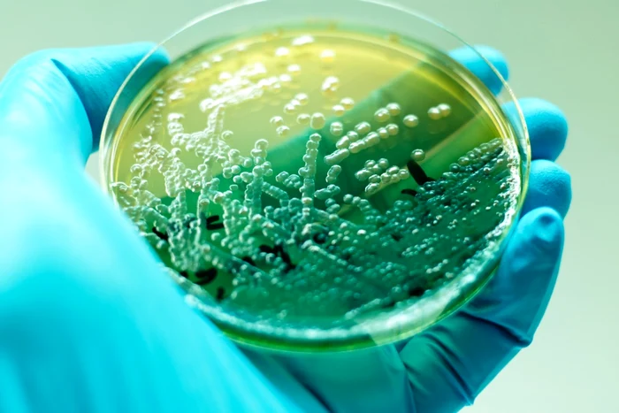 Bacteria Pseudomonas aeruginosa în mediu de cultură FOTO SHUTTERSTOCK