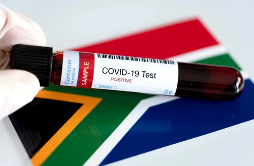 Infecția cu tulpina sud-africană a noului coronavirus a fost confirmată și în Româniafoto: Shutterstock