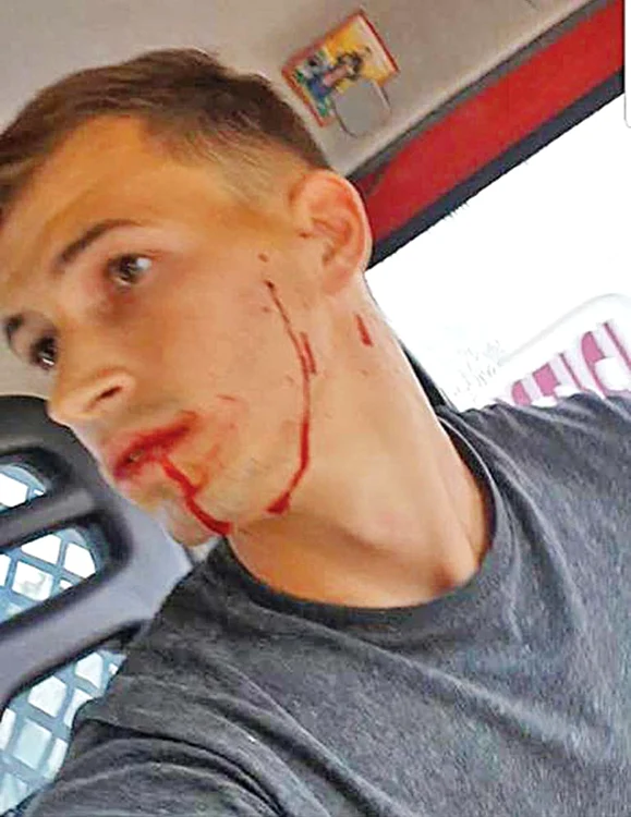 Șoferul dubiței a fost rănit la față