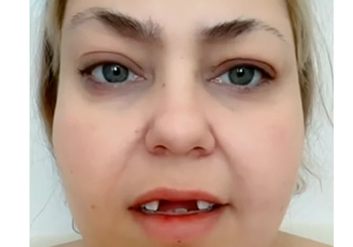 Transformarea uluitoare a unei utilizataoare de TikTok Foto: Captură video