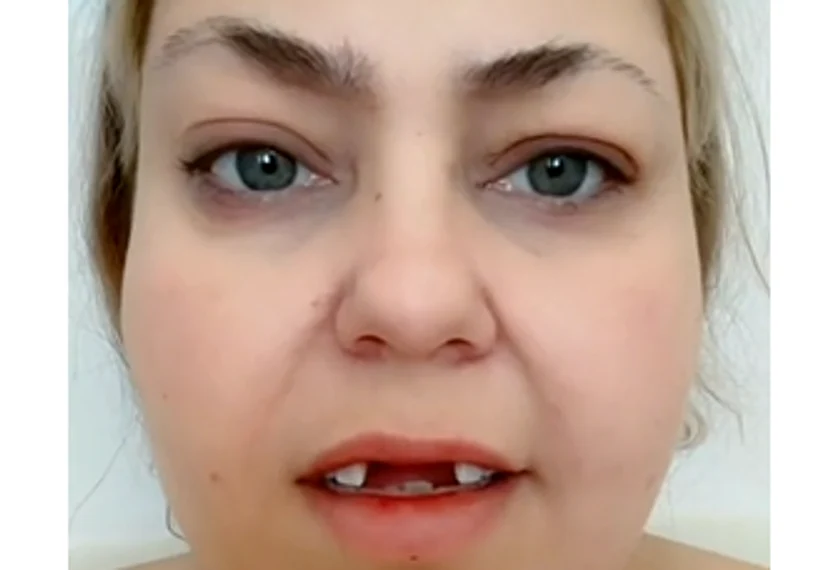Transformarea uluitoare a unei utilizataoare de TikTok Foto: Captură video