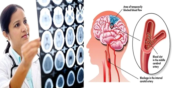 1 durerea ta de cap poate fi fatala uite la ce semne trebuie sa fii atenta ny2n jpg jpeg