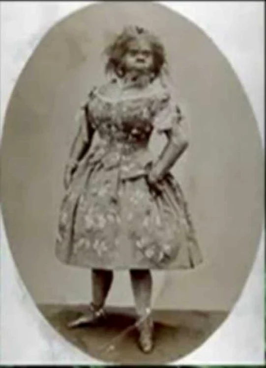 Julia Pastrana 