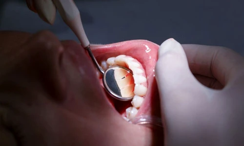 1 73185 original jpg jpeg