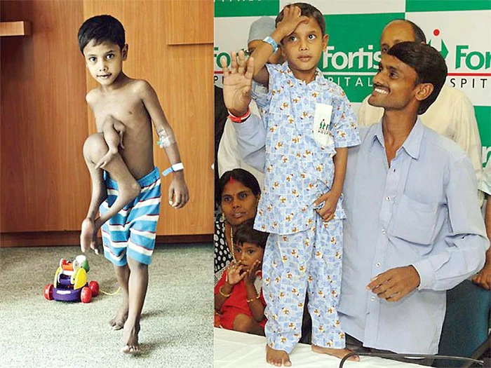 
    După operaţieFoto: Spitalul „Marie Curie”  