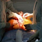 operatie plamani piept torace medici foto shutterstock
