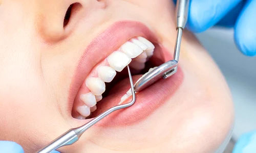 implant dentar omniadental jpg