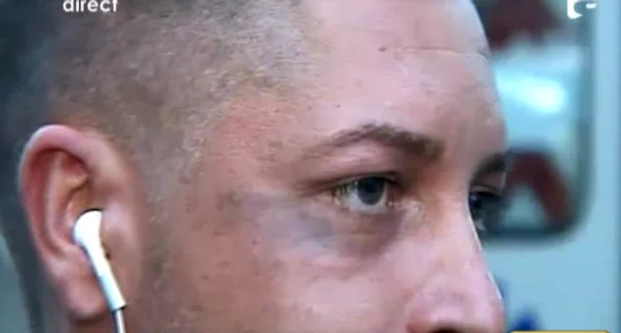 Ovidiu Danci, bătut (captură Antena 1)