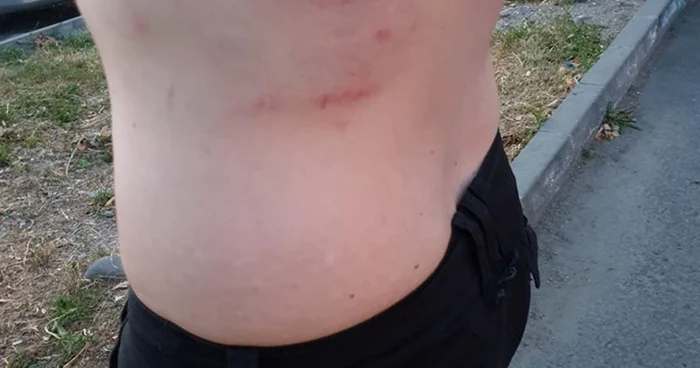 Tânărul a ajuns la UPU cu vânătăi pe tot corpul. FOTO: Arhivă personală