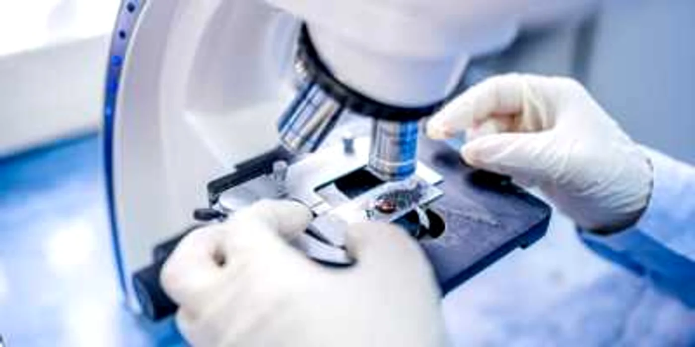 Diagnosticul a fost stabilit în laborator FOTO: Shutterstock