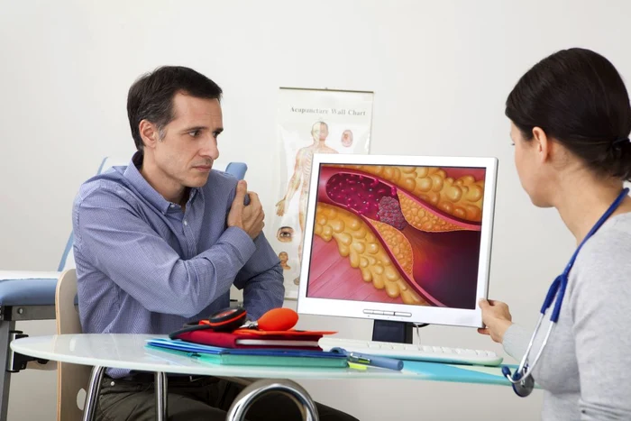 Colesterolul „rău” crescut înseamnă risc mare cardiovascular FOTO: arhiva