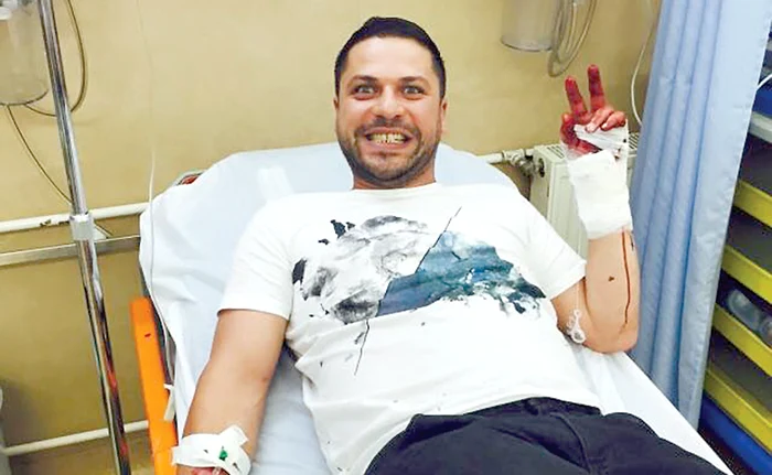 Aşa arăta mâna lui Augustin Viziru la câteva ore după accidentul suferit în 31 mai 2015