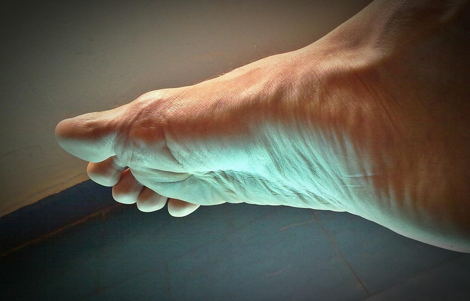 Un bărbat care s-a plâns de slăbiciunea piciorului a aflat că are creierul mic. Care este explicația neurologilor