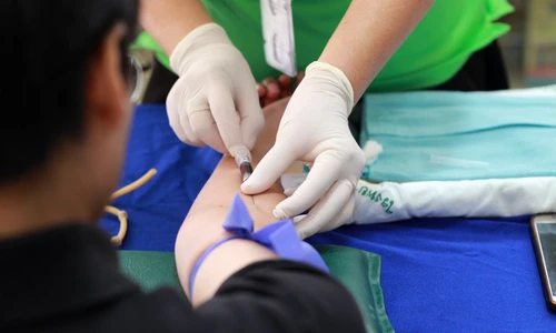 1 sindromul gilbert ce este si de la ce apare jpg jpeg