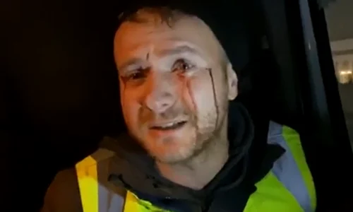 bodnar 0 png