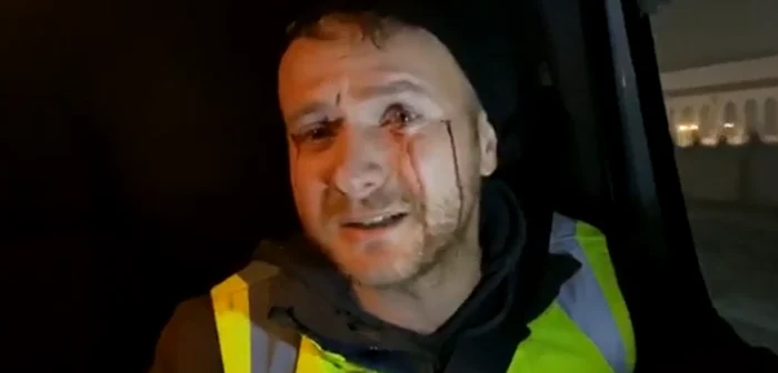 
    Daniel Bodnar a fost agresat de hoții de lemne în județul SuceavaFoto: adevarul.ro  