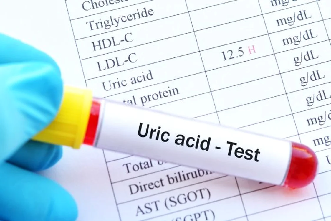 1 acid uric jpg jpeg