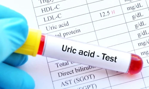 1 acid uric jpg jpeg