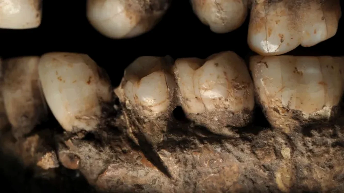 Partea stângă a maxilarului inferior prezintă o tăietură lângă un premolar (© Ana Pantoja et al.)