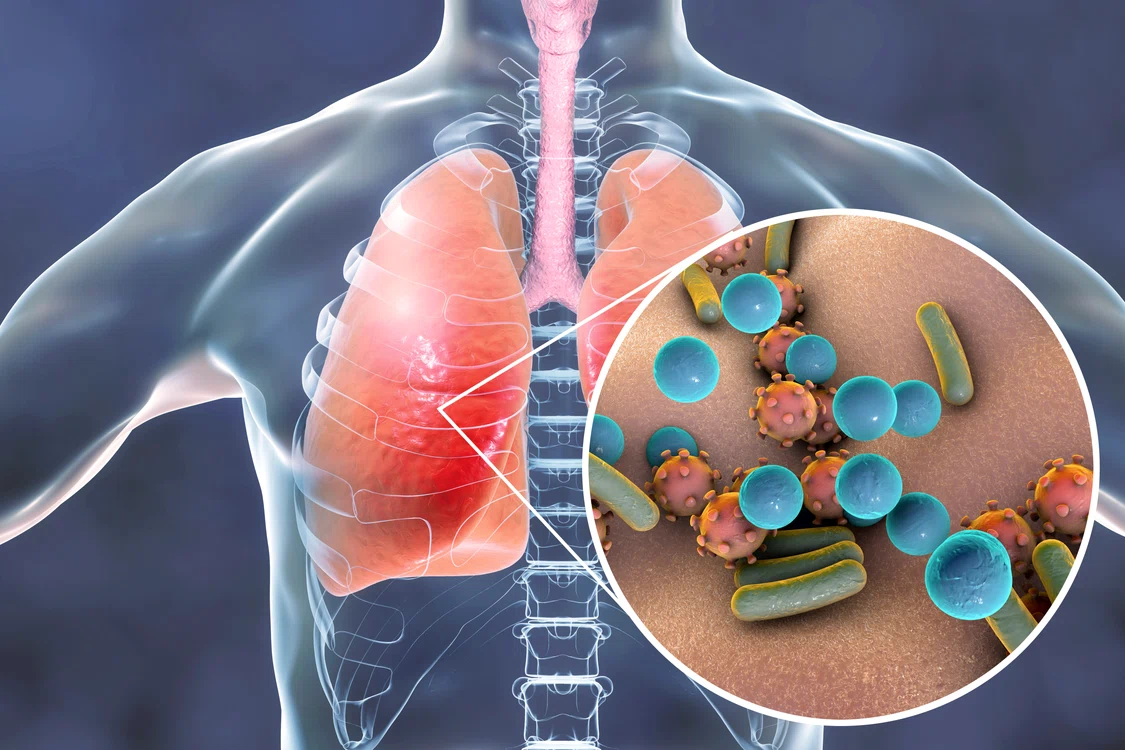
    Coronavirusul din China provoacă pneumonia letală  