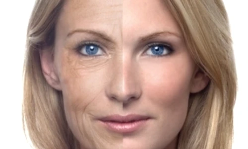 1 3 trucuri care te scapa rapid si ieftin de riduri sq0j jpg jpeg