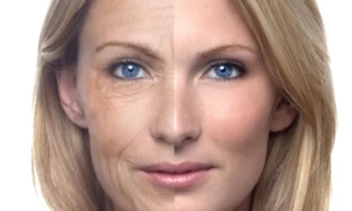 1 3 trucuri care te scapa rapid si ieftin de riduri sq0j jpg jpeg